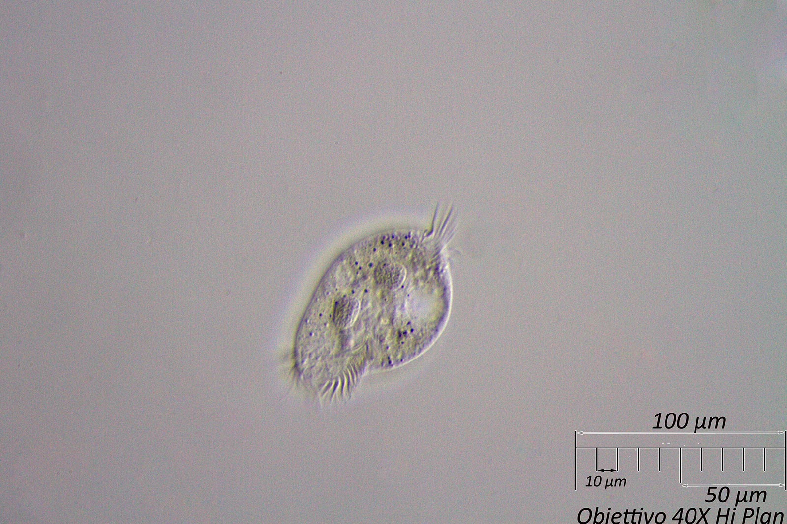 Ciliato 2