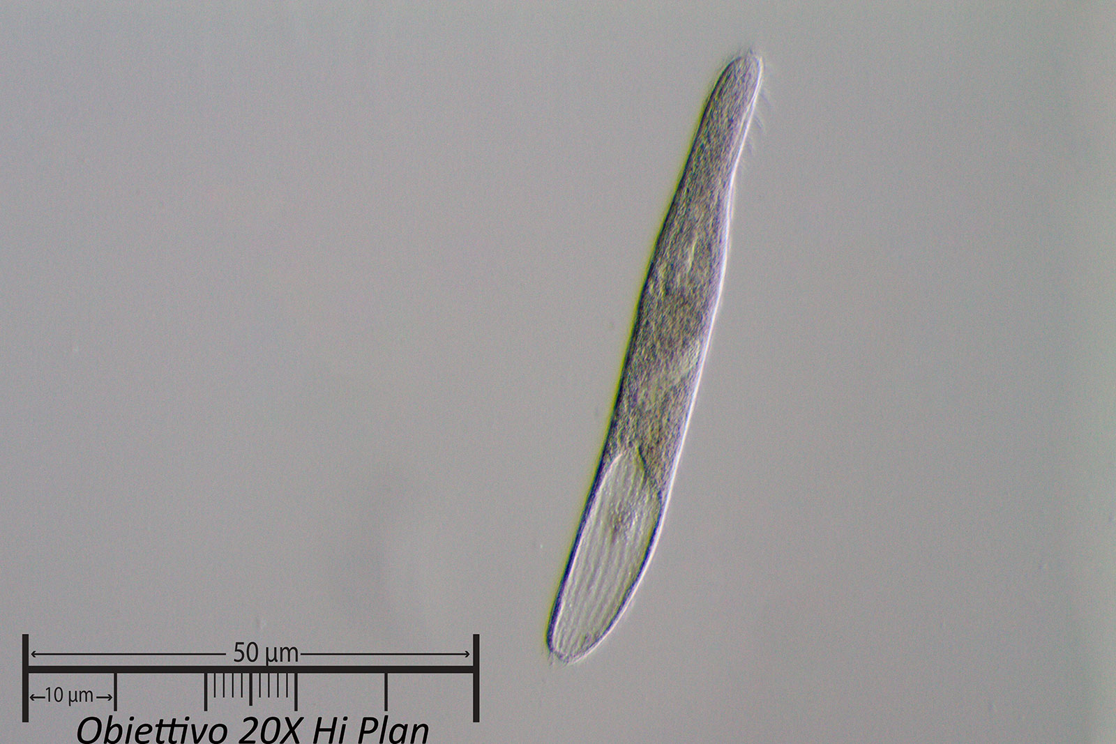 Ciliato 1