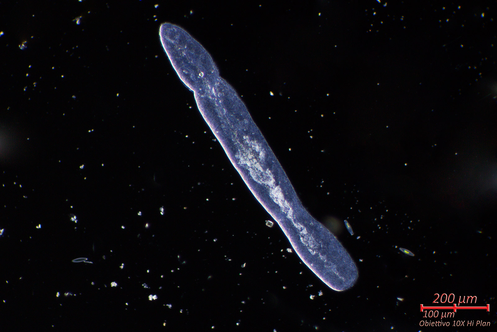 Nematode?