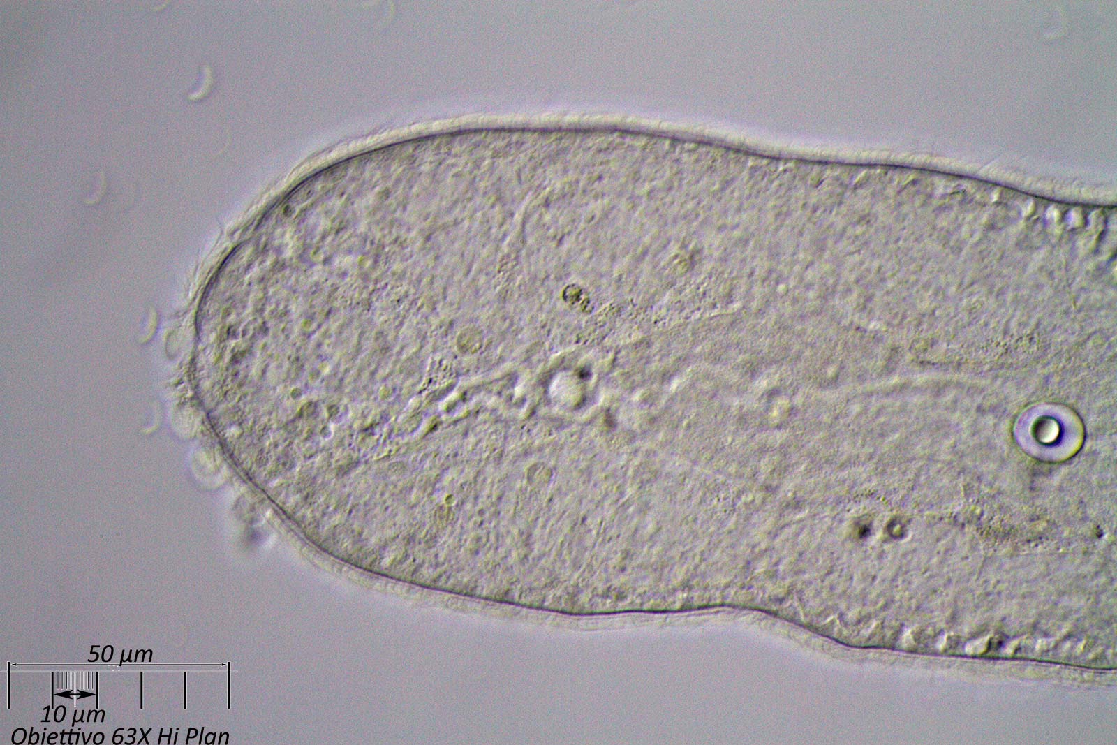 Nematode?