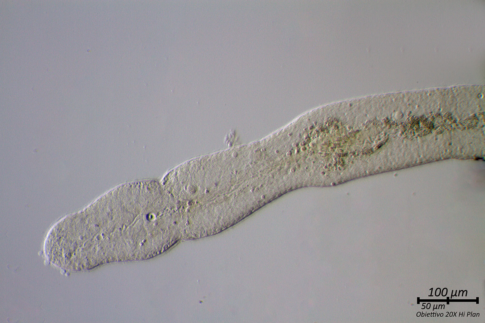 Nematode?