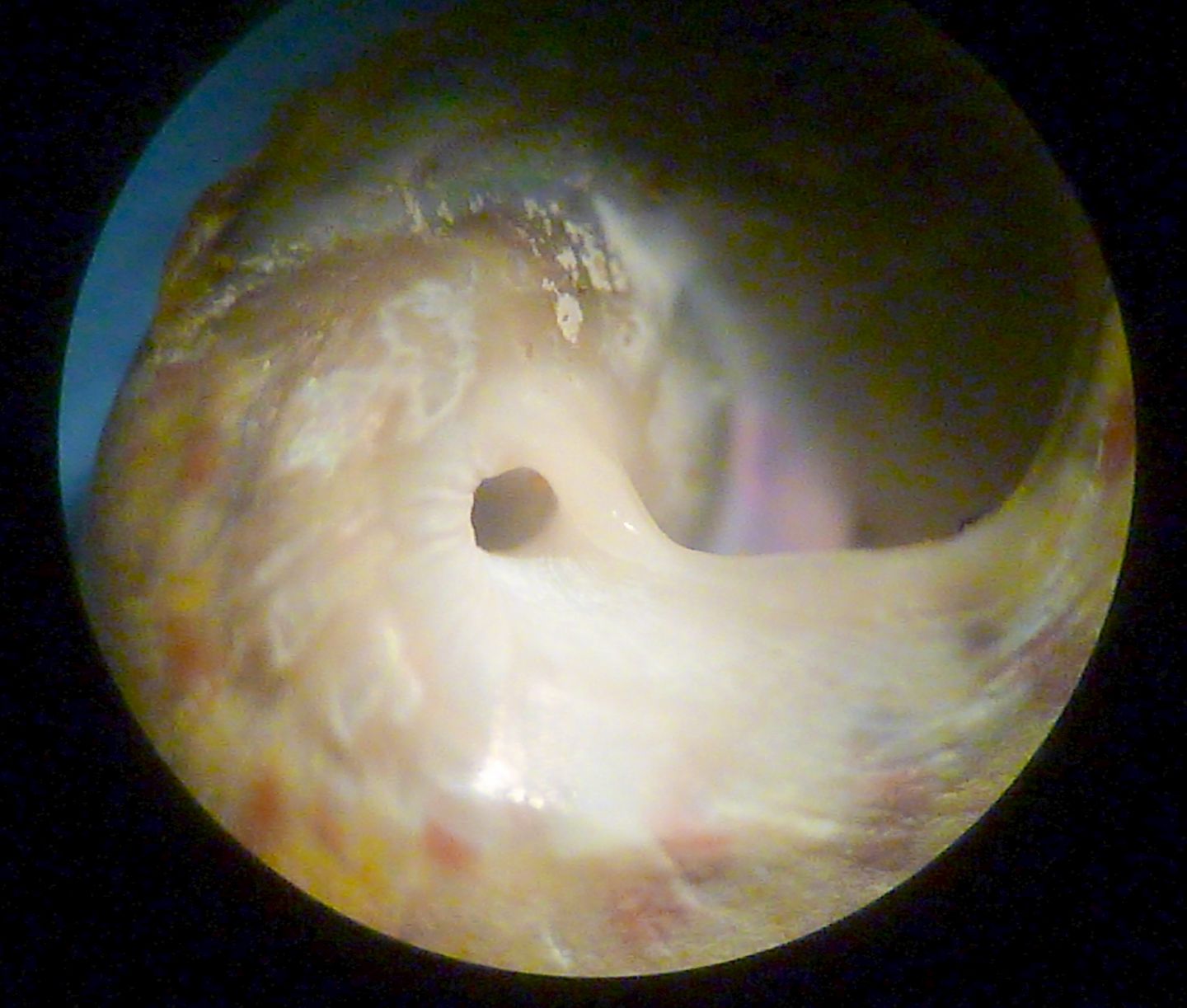 Trochide da determinare