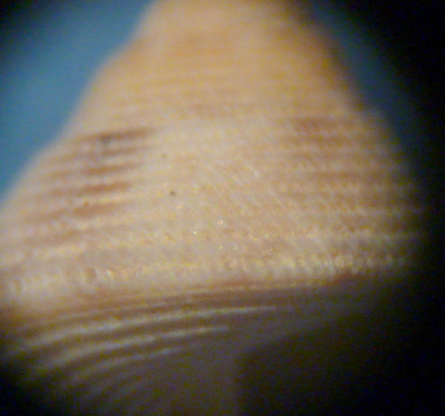 Trochide juv.