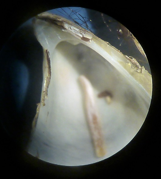 Mytilaster minimus?
