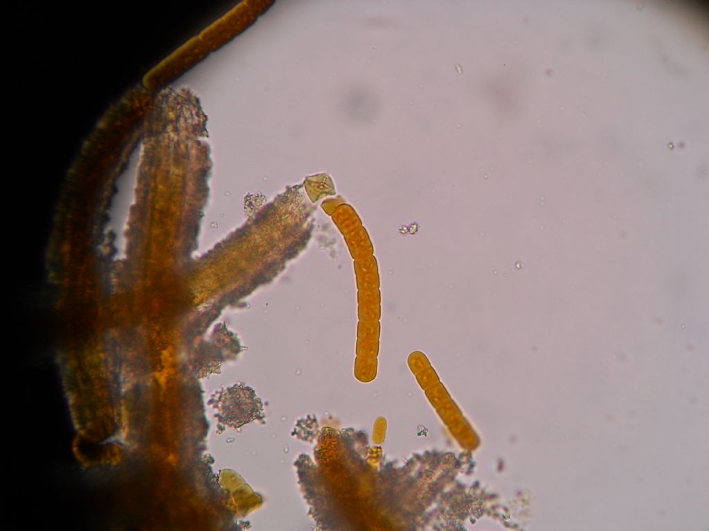 cianobatterio ancora da micro e da stereo