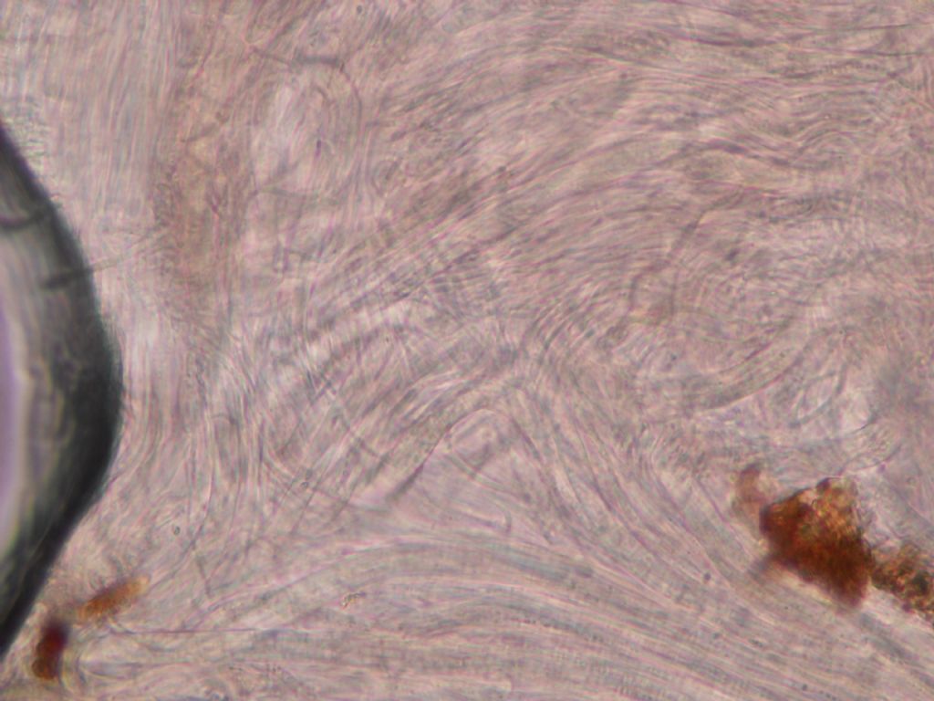 ascomicete - chi �?