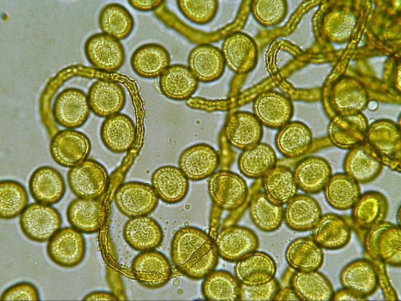 Perichaena vermicularis