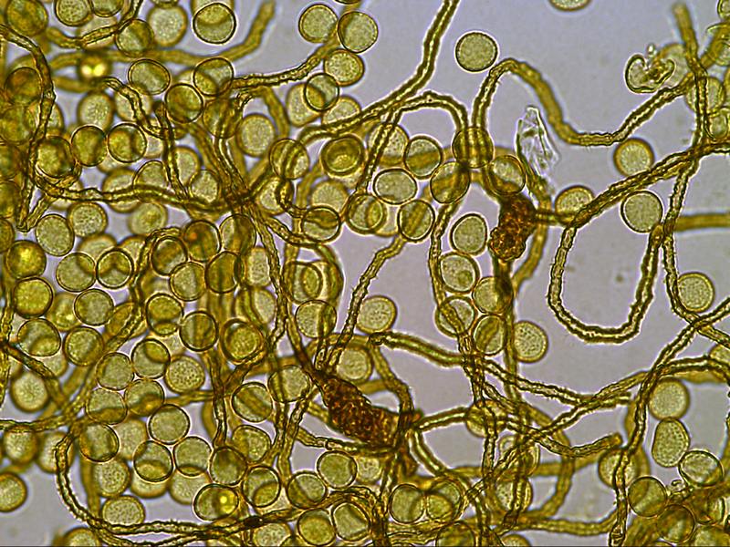 Perichaena vermicularis