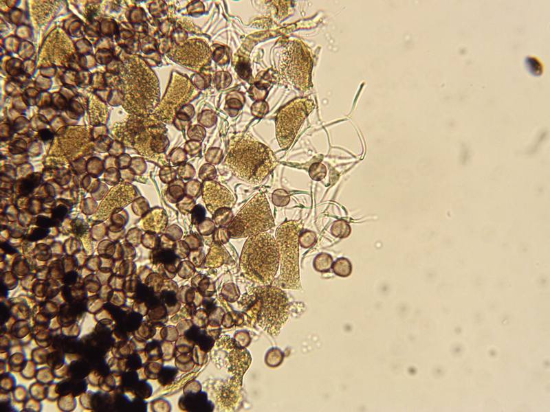 Physarum globuliferum