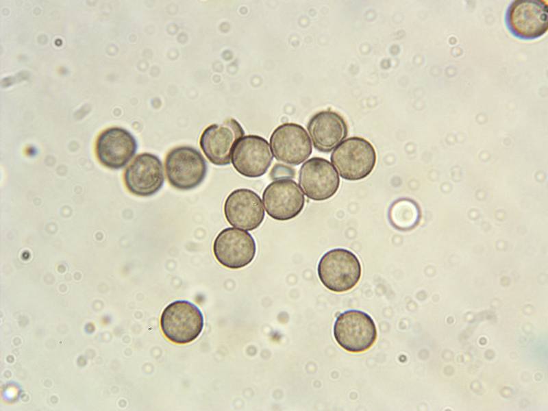 Lamproderma arcyrionema