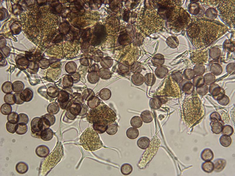 Physarum globuliferum