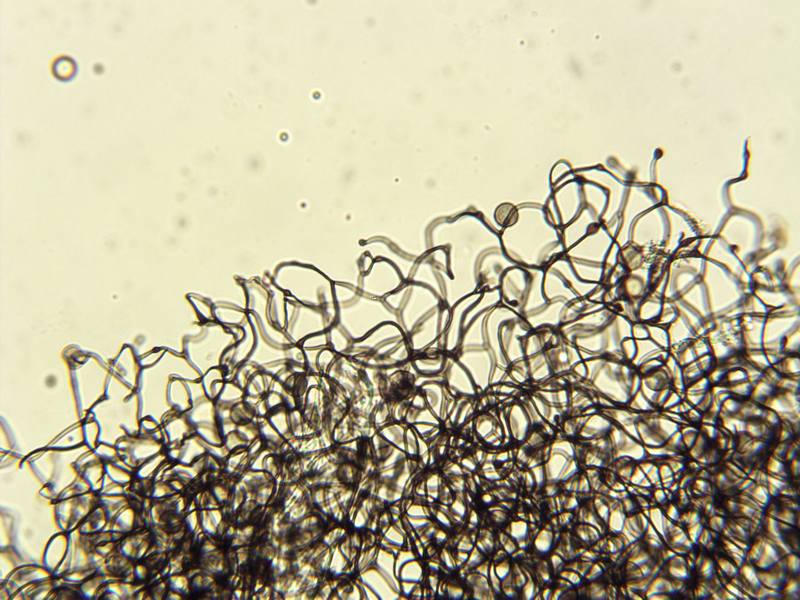 Lamproderma arcyrionema