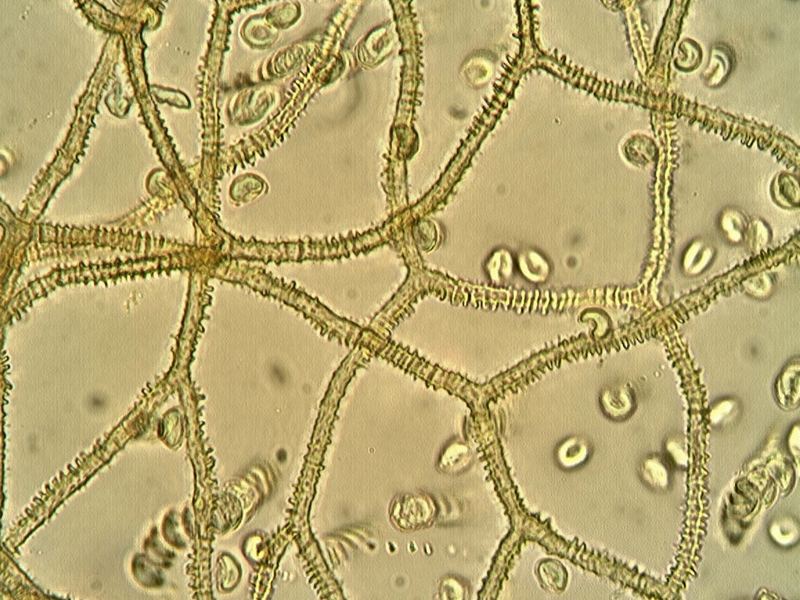 Myxo forma pseudoaethelium caffelatte
