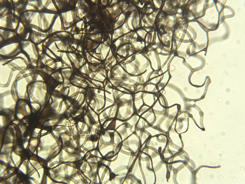 Lamproderma arcyrionema