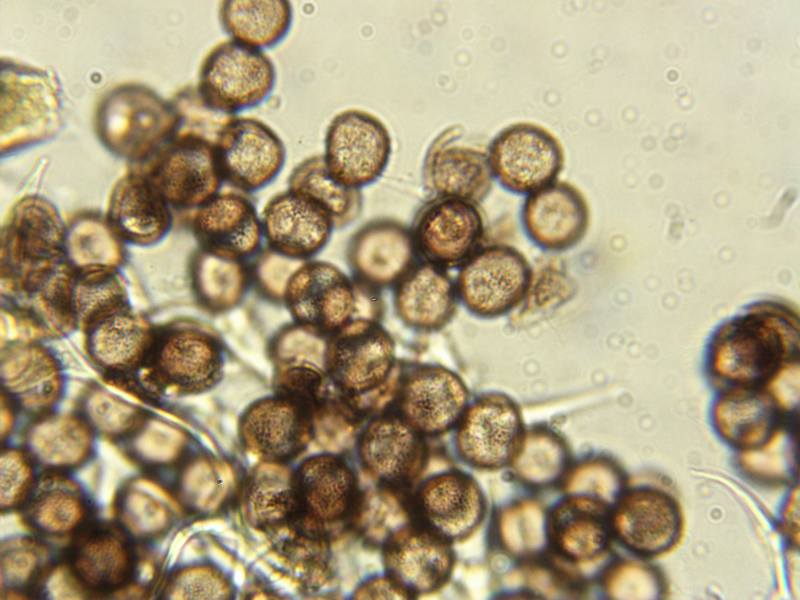 Physarum globuliferum