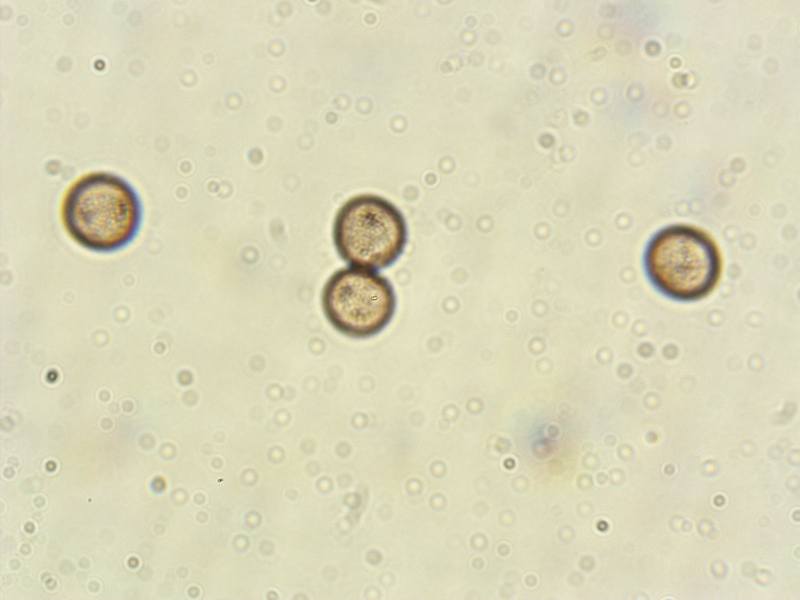 Physarum globuliferum