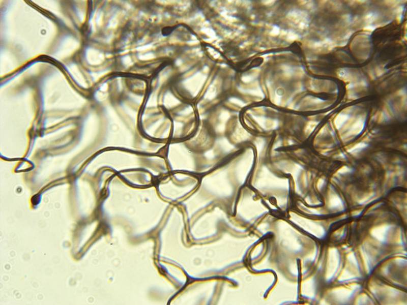 Lamproderma arcyrionema