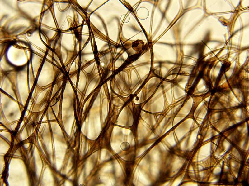 Myxo forma pseudoaethelium caffelatte