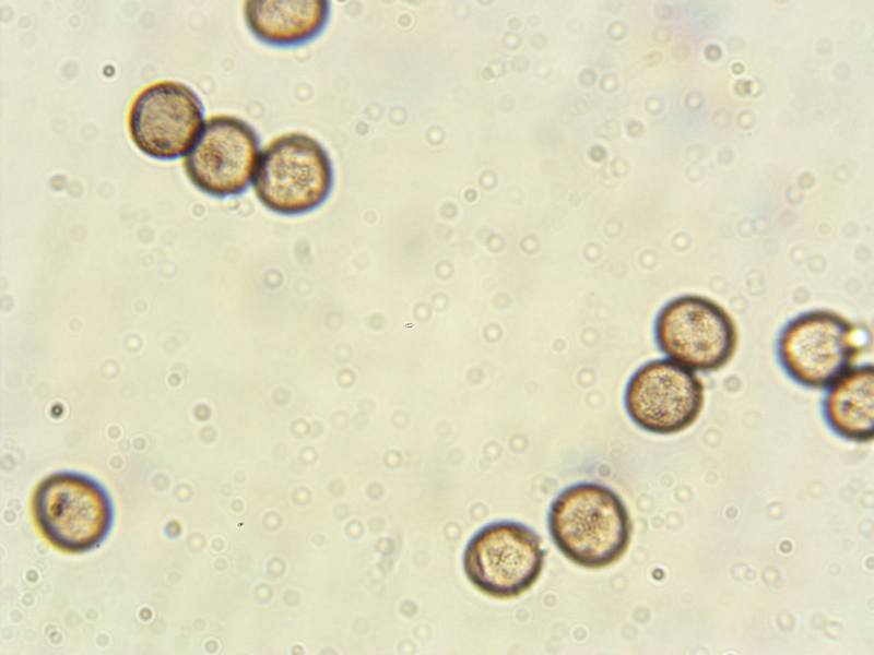 Physarum globuliferum