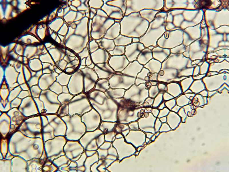 Stemonitis herbatica??