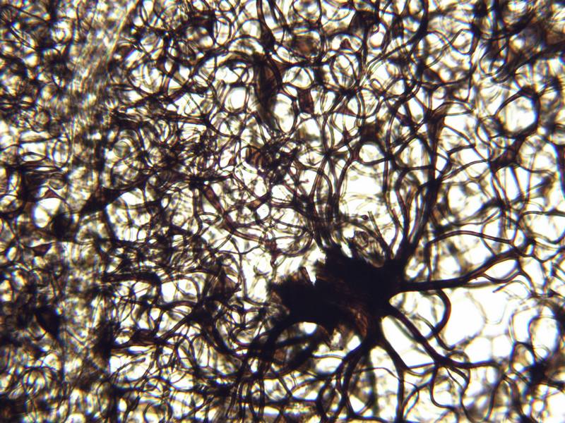 Lamproderma arcyrionema