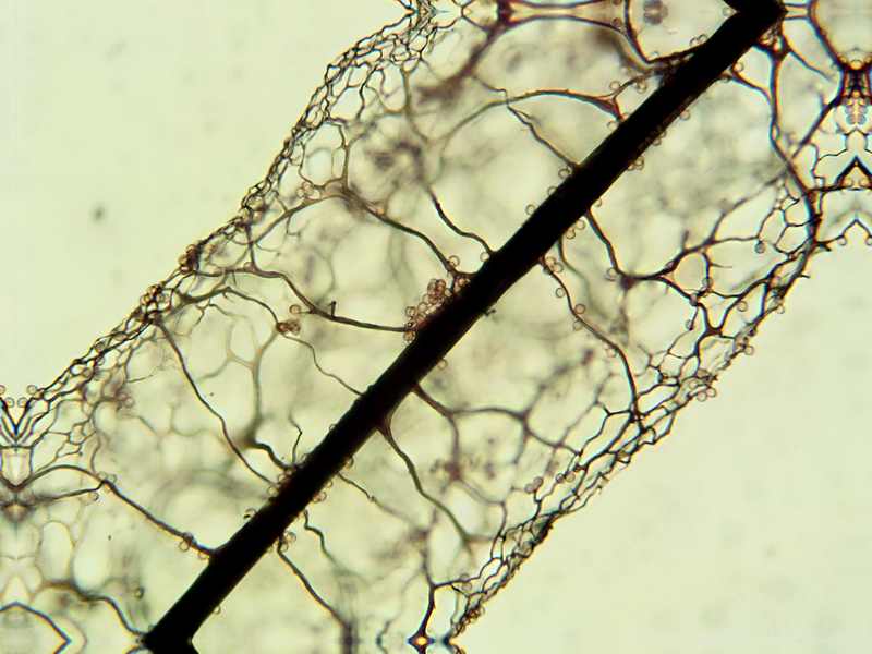 Stemonitis herbatica??