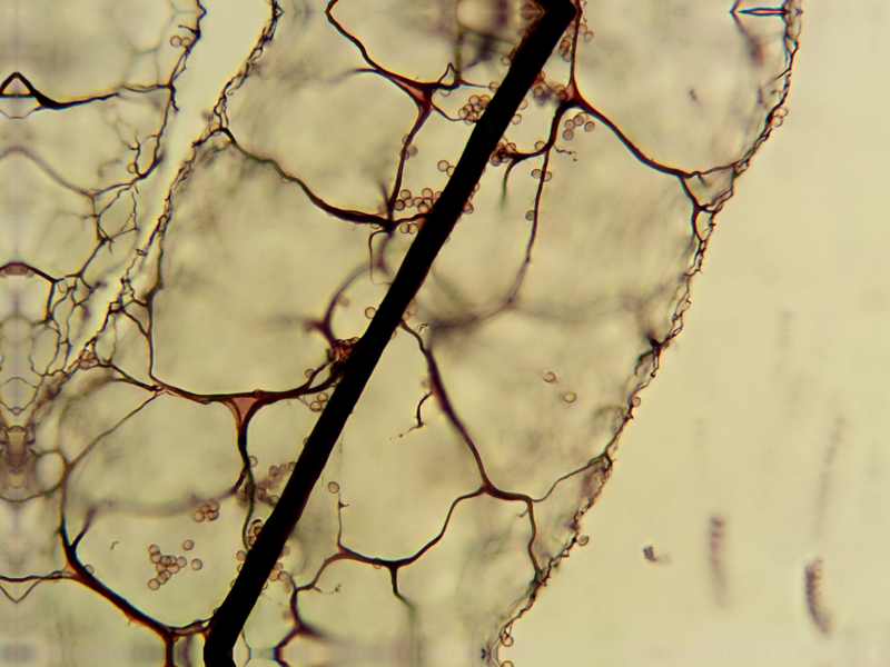 Stemonitis herbatica??