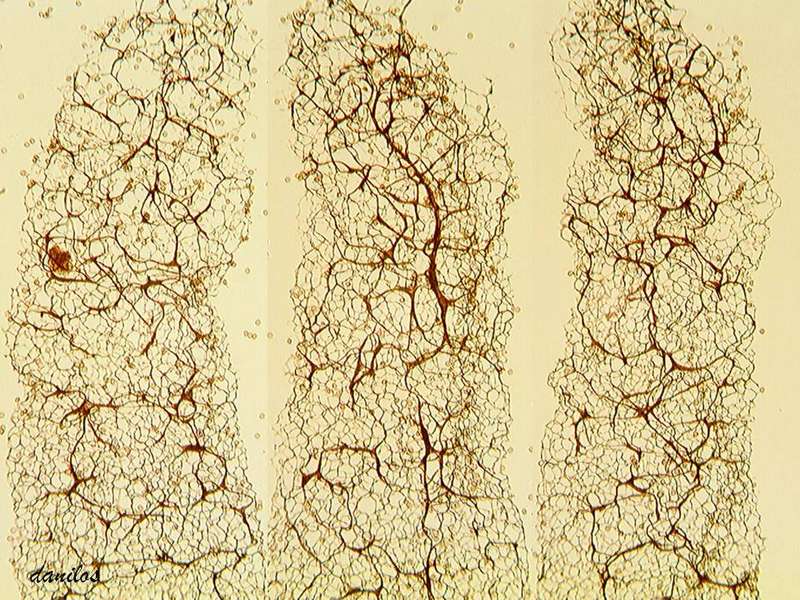 Stemonitis splendens ??