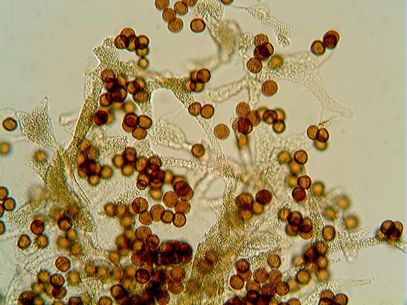 Badhamia foliicola??