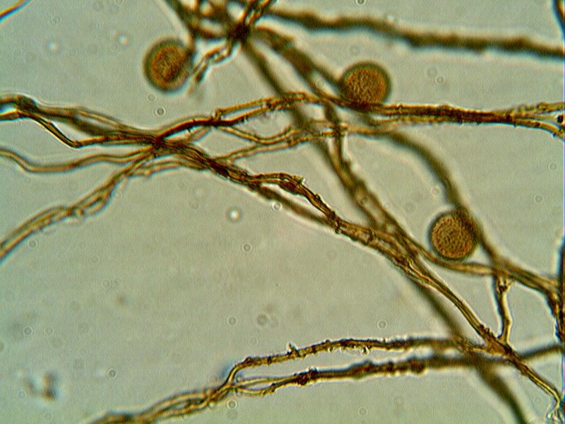 Escursione Monte Baldo 4