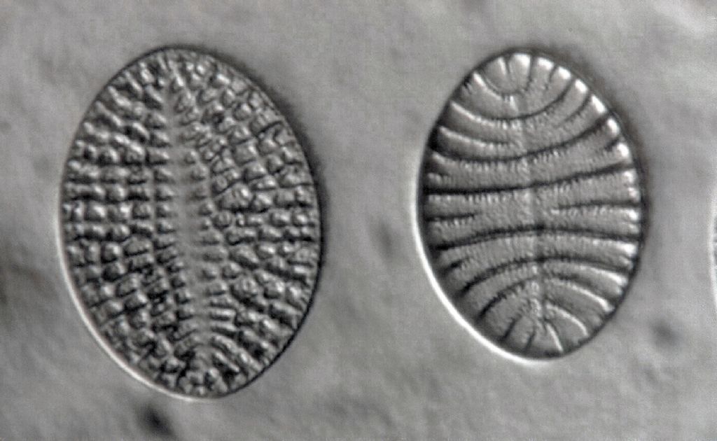 Coppia di diatomee III