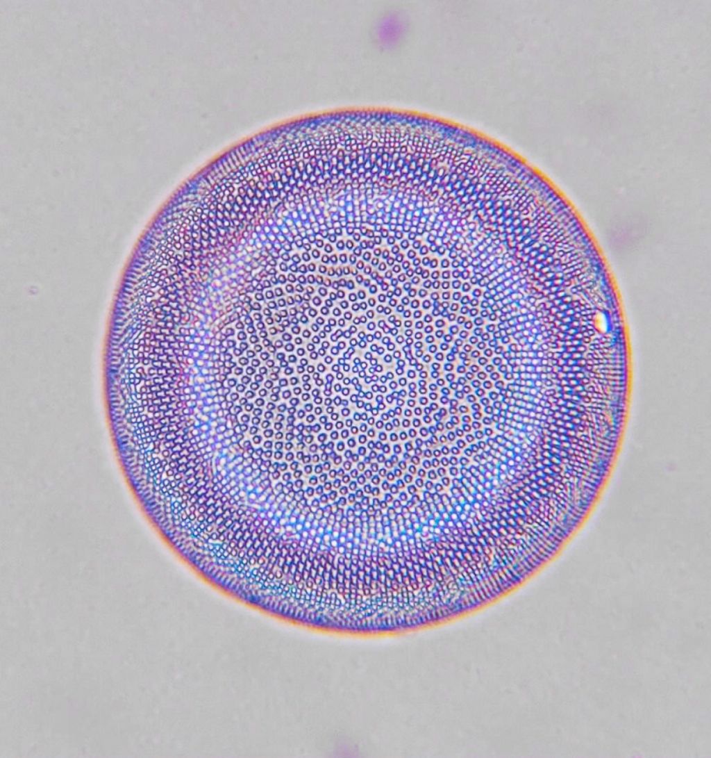 Diatomea