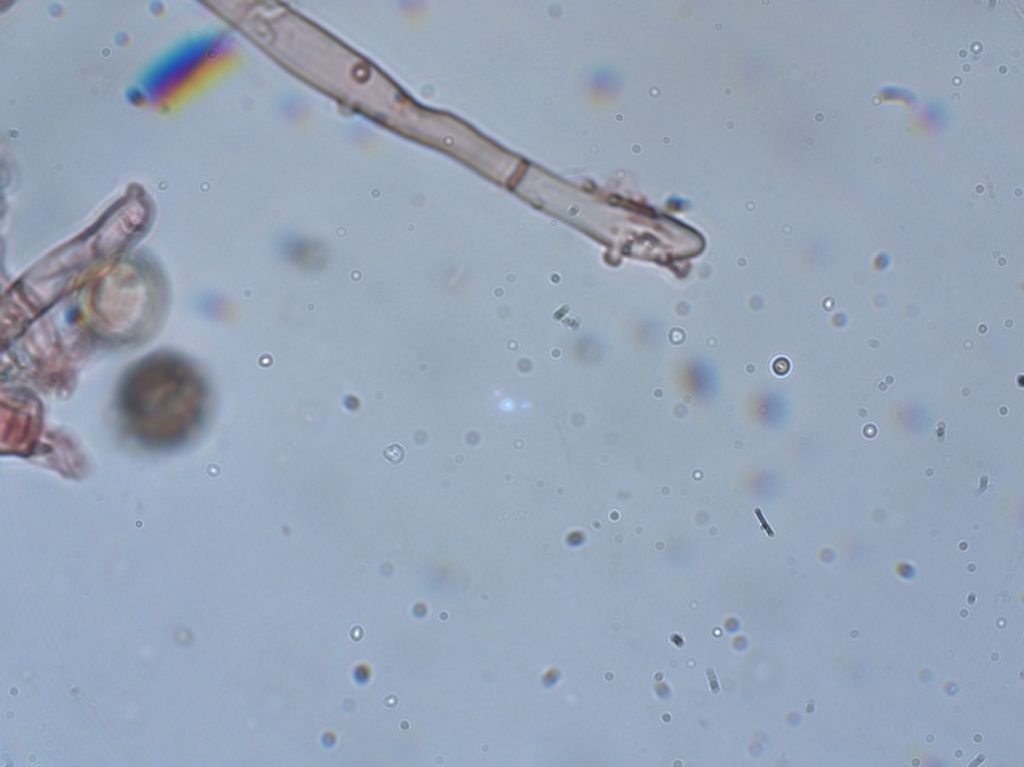 Penso a Botryobasidium (Haplotricum) conspersum