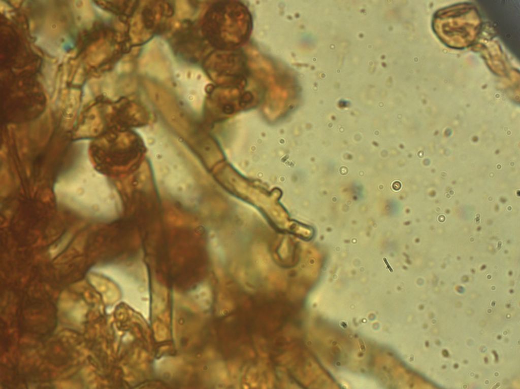 Penso a Botryobasidium (Haplotricum) conspersum