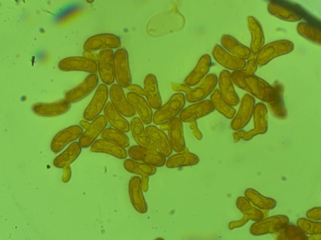Spore di Hyphoderma medioburiense?