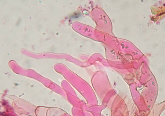 tomentella (Tomentella sublilacina)