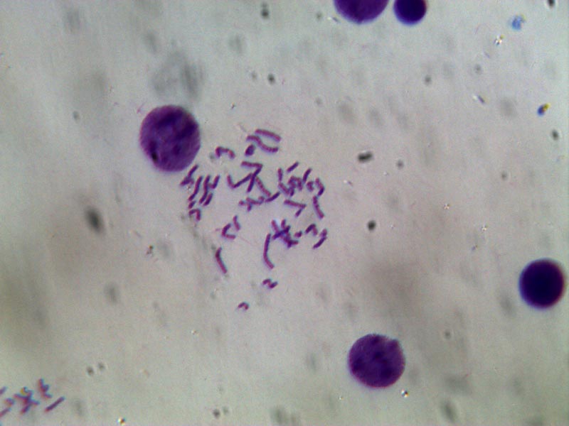 1 microscopio +  binocolo = infinito