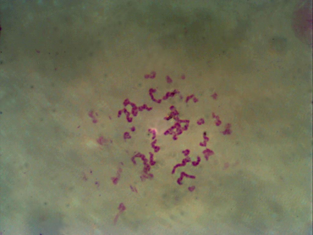 1 microscopio +  binocolo = infinito