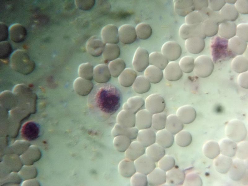 Surirella robusta