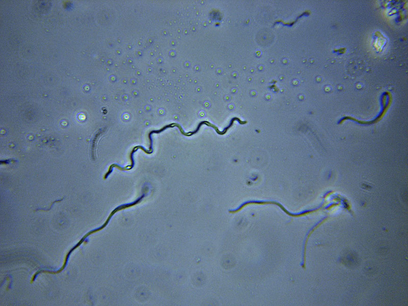 Слизь как белок. Спирохеты боррелии. Спириллы бактерии. Цисты спирохет.
