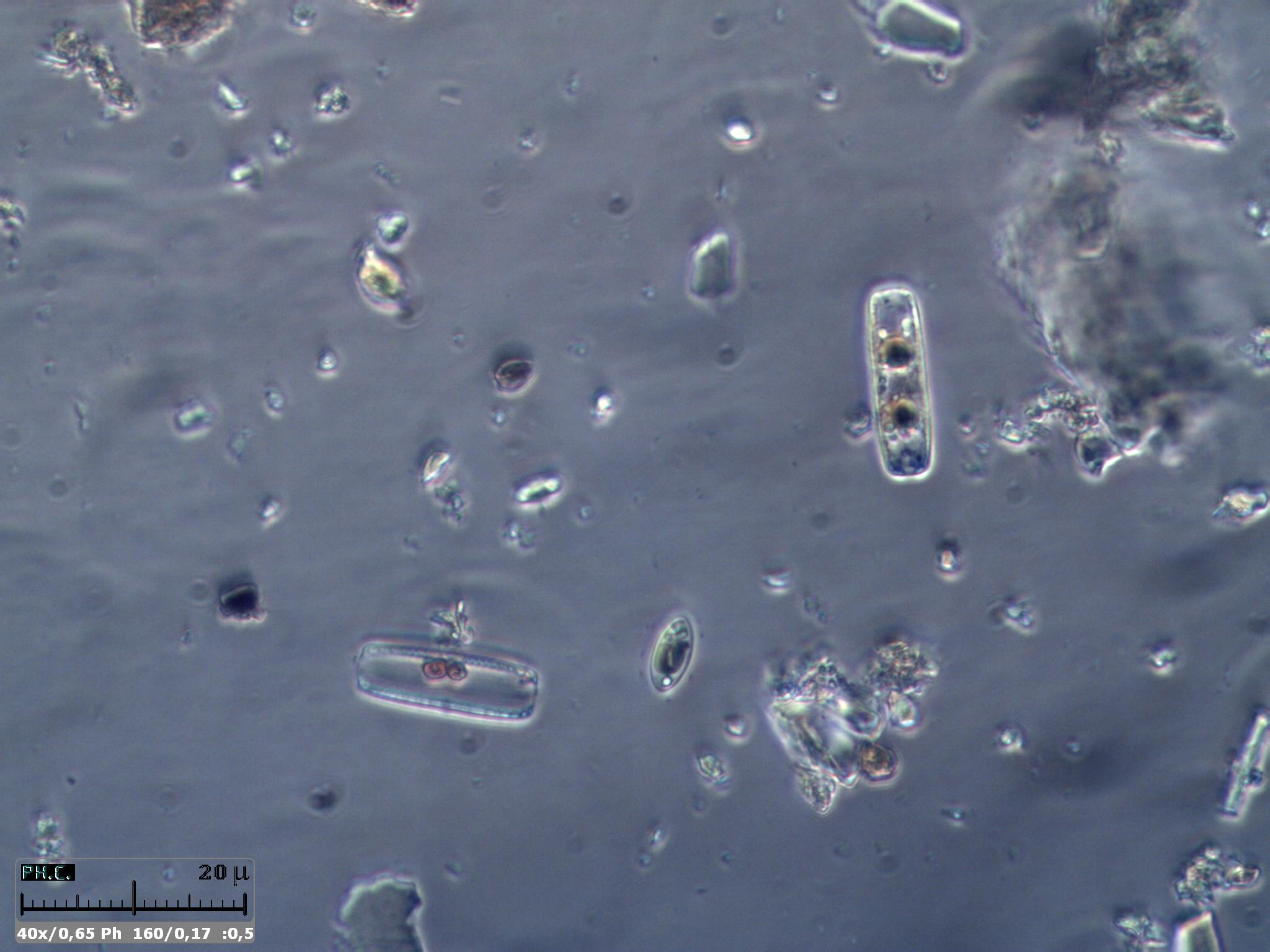 Piccole diatomee in CdF