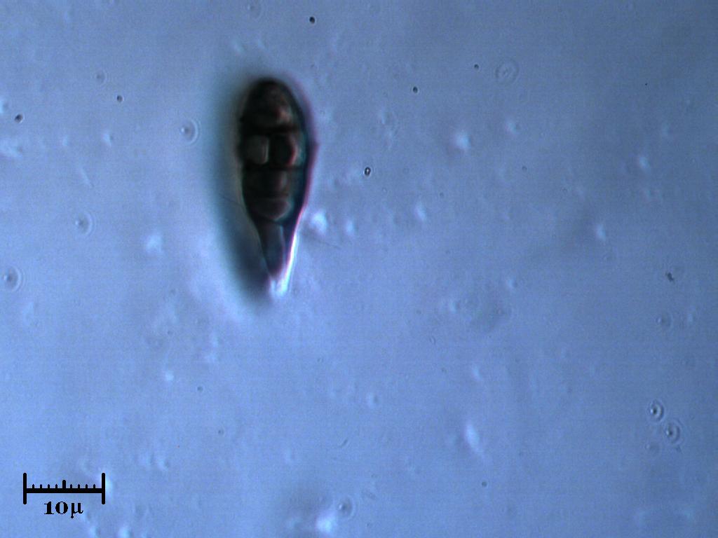 Pinnularia -  Ricordando Esco...