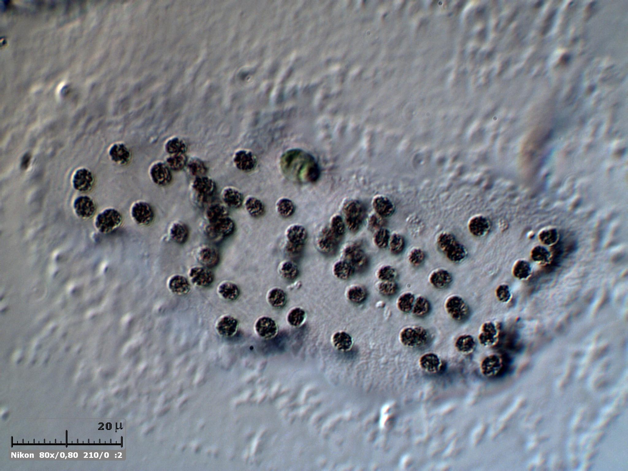 Microcystis (cianobatteri sicuri)