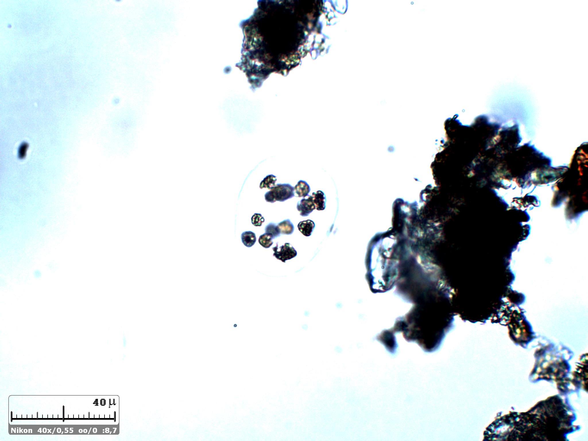 Qualche Microcystis 