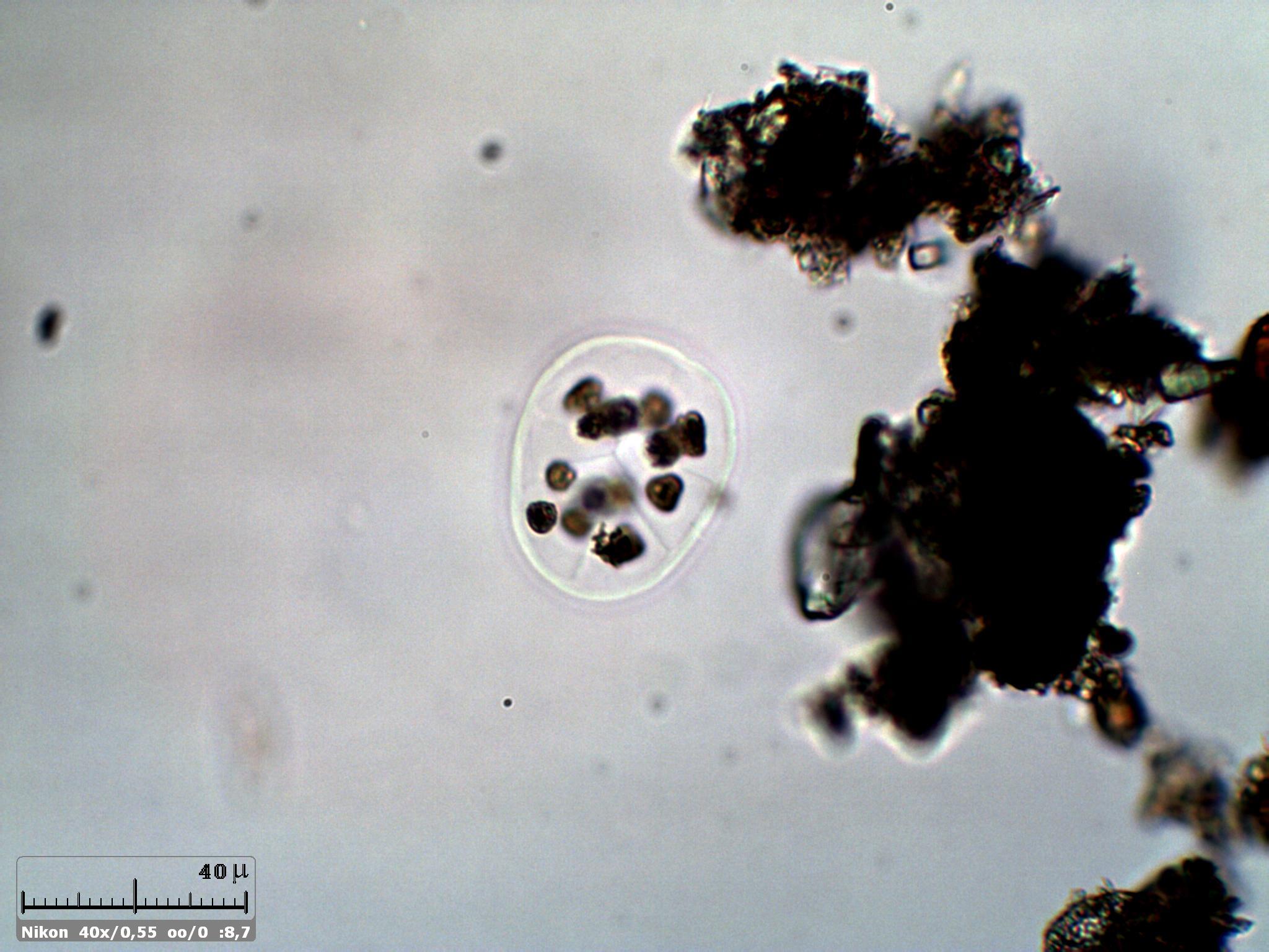 Qualche Microcystis 