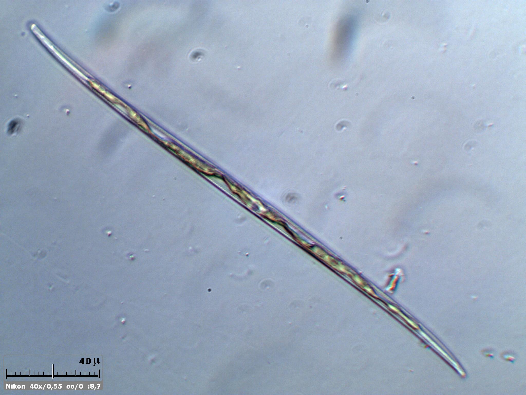 Diatomea