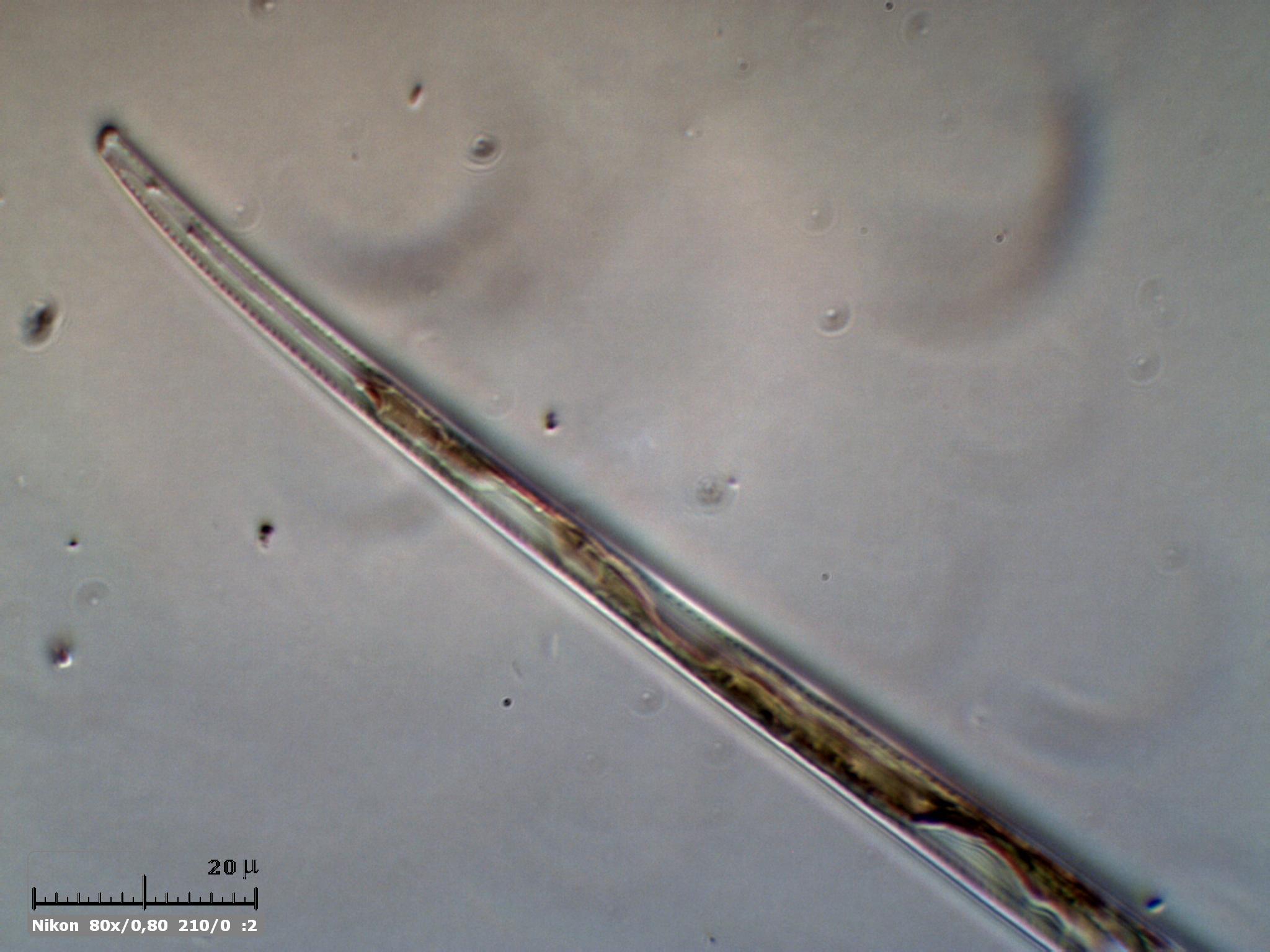 Diatomea