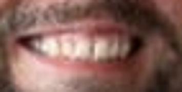 Axio Scope.A1 arrivato!