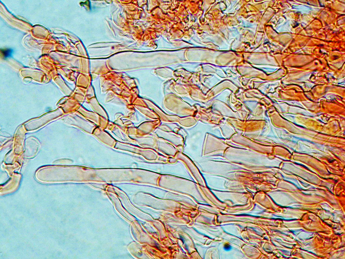 Hyphodontia alutacea (Fr.) J. Erikss.