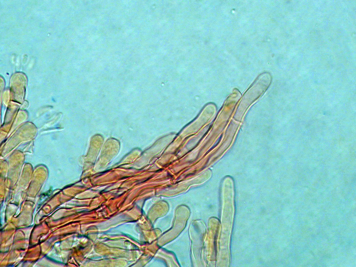 Hyphodontia alutacea (Fr.) J. Erikss.